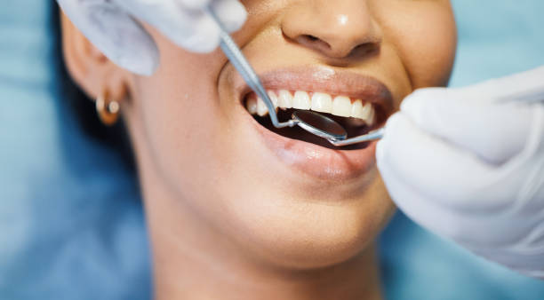 Best Emergency Dental Extractions in Sherwood, AR