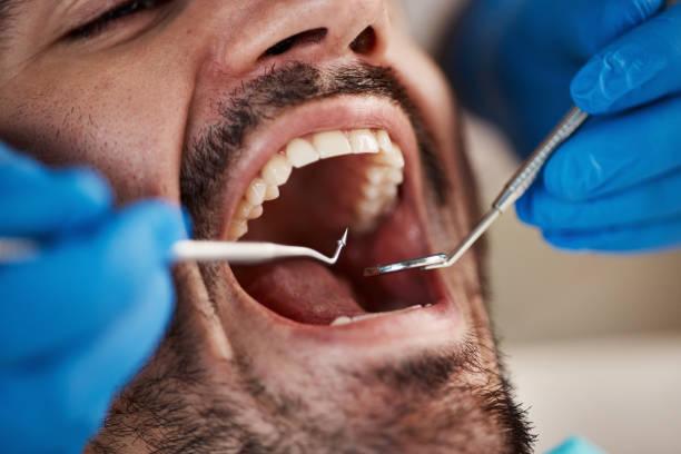 Best Emergency Dentist for Knocked-Out Tooth in Sherwood, AR